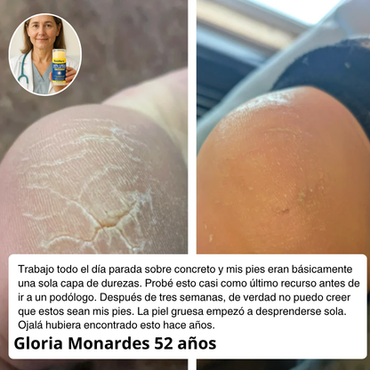 Barra de Urea para Pies | Reparación clínica que transforma tus talones